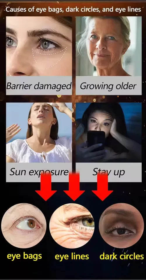 selling wrinkle removing eye cream, eye bags, dark circles, anti swelling, firming, brightening, fine lines, moisturizing tool