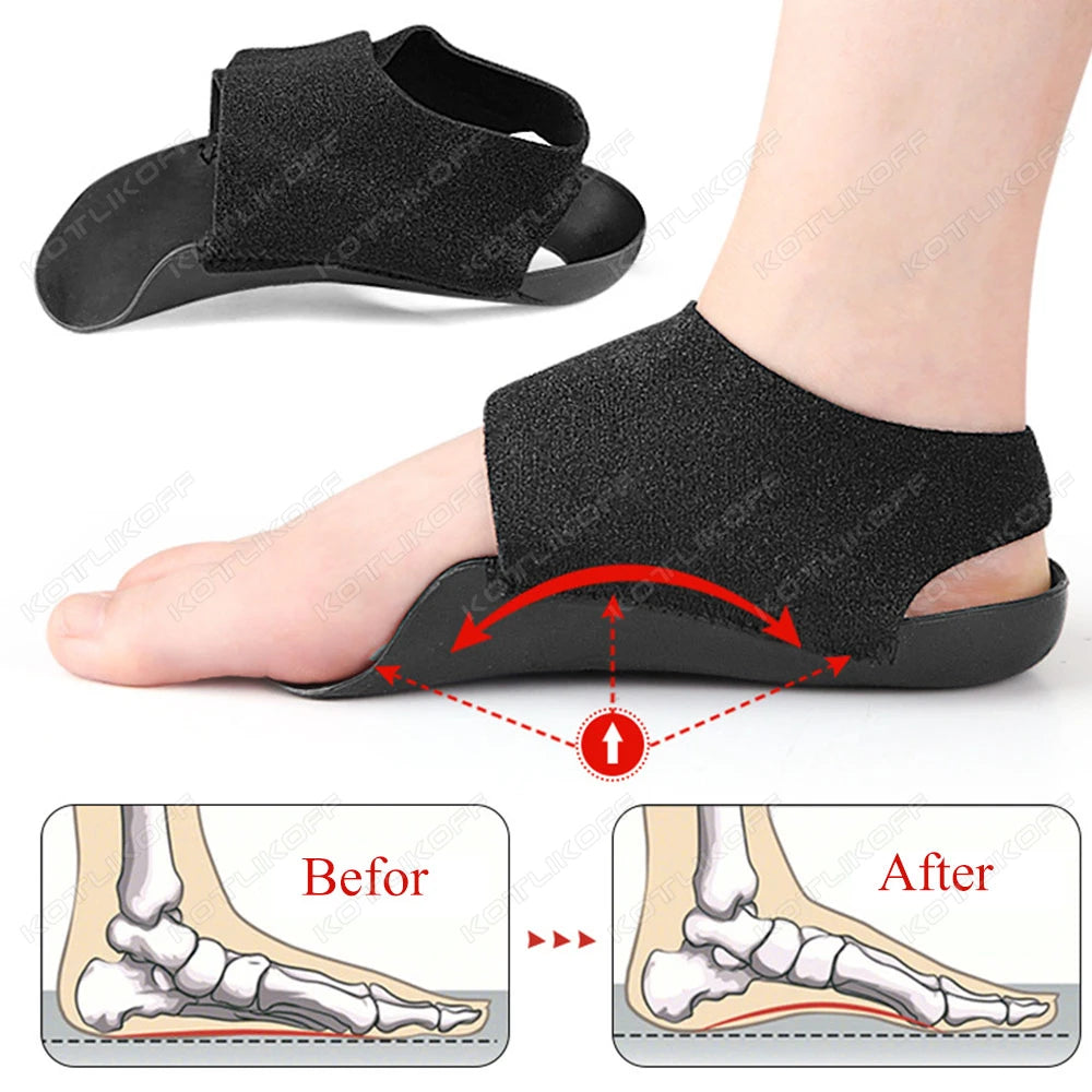 KOTLIKOFF Arch Support Orthopedic Insole For Walk With Arch Half Pad X/O Type Leg With Velcro Strap Wearable Shoe Heel Cover