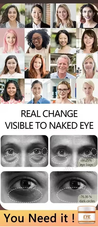 selling wrinkle removing eye cream, eye bags, dark circles, anti swelling, firming, brightening, fine lines, moisturizing tool