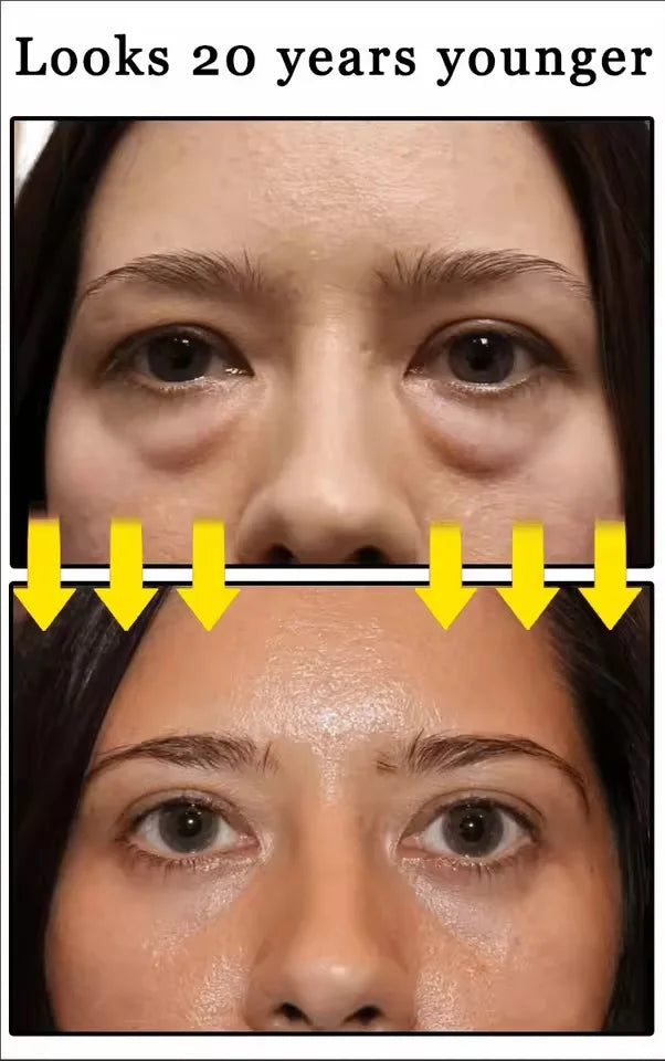 selling wrinkle removing eye cream, eye bags, dark circles, anti swelling, firming, brightening, fine lines, moisturizing tool