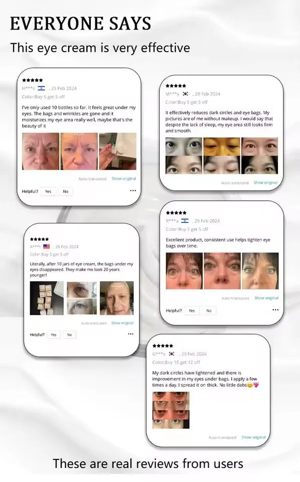 selling wrinkle removing eye cream, eye bags, dark circles, anti swelling, firming, brightening, fine lines, moisturizing tool